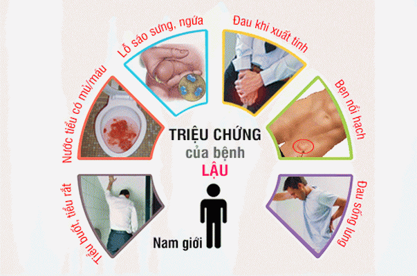 bệnh lậu