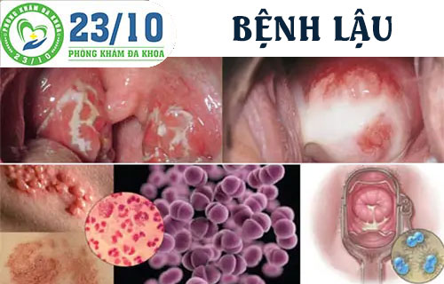 co nhung benh xa hoi nao