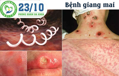 tu van benh xa hoi o dau