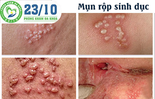 bac si tu van benh xa hoi